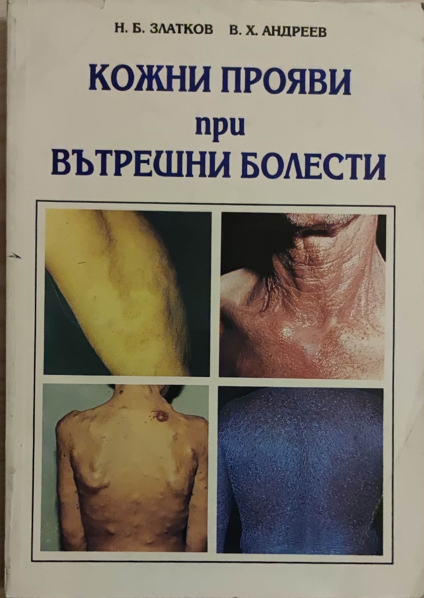 Кожни прояви при вътрешни болести | Ортограф - антикварна книжарница