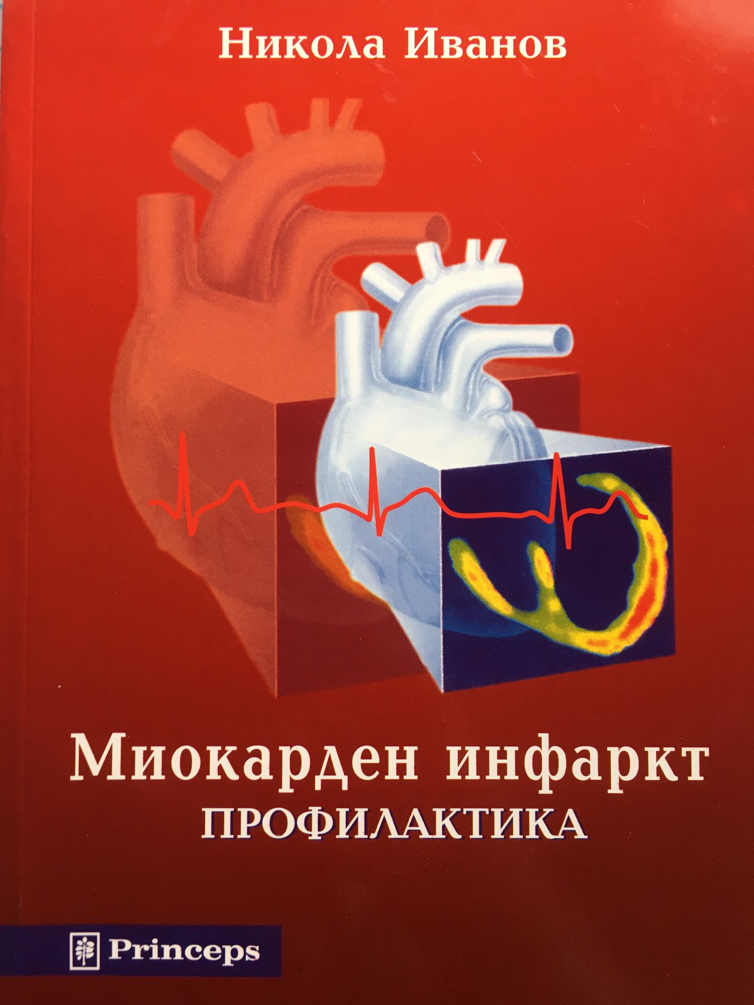 Миокарден инфаркт: Профилактика | Ортограф - антикварна книжарница